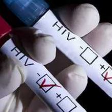Пройти экспресс-тестирование на ВИЧ-инфекцию