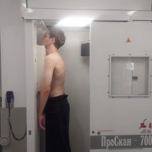 Более 70 тысяч первоуральцев обследовались на туберкулез в прошлом году