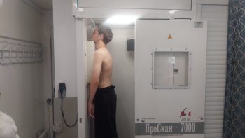 Более 70 тысяч первоуральцев обследовались на туберкулез в прошлом году
