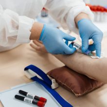 Анализ на фракции холестерина стал частью стандартной диспансеризации